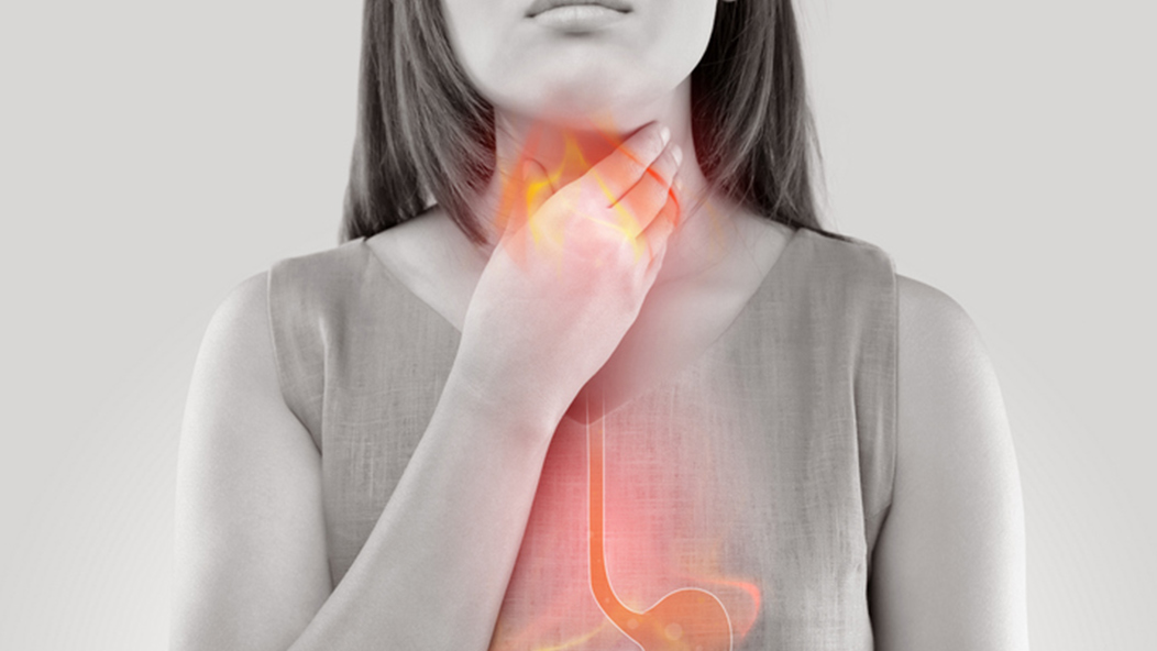 Acid reflux could be the cause persistent cough