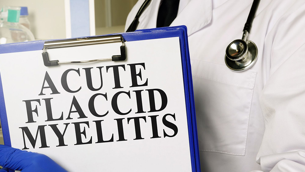 Acute flaccid myelitis outbreak threatens 2020