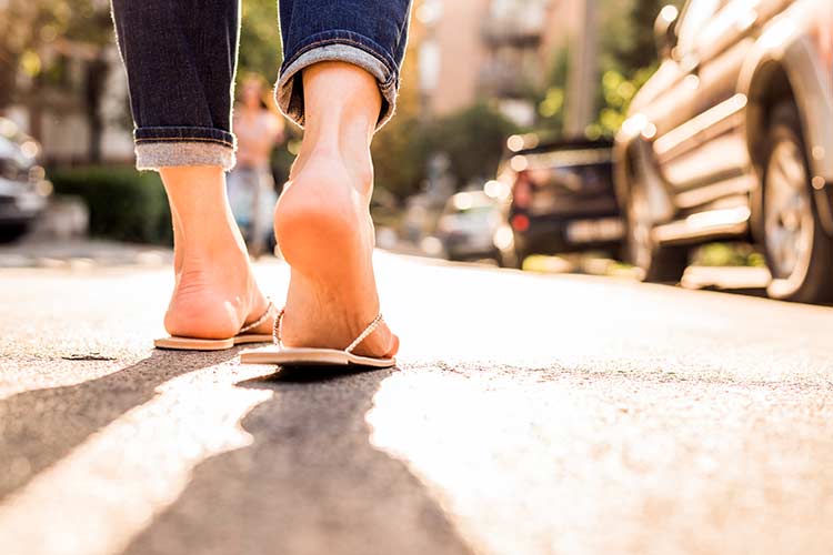 How to Treat Cracked Heels