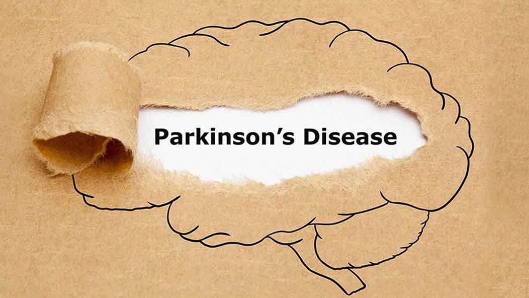 A brain is drawn on brown paper. In the middle of the drawing, the paper is ripped aside to reveal the words 'Parkinson's Disease.'