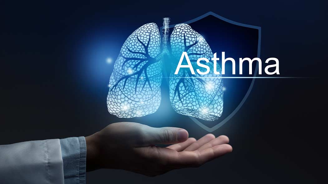 Asthma Asthma