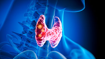 Understanding Thyroid Health Kelsey Seybold Clinic