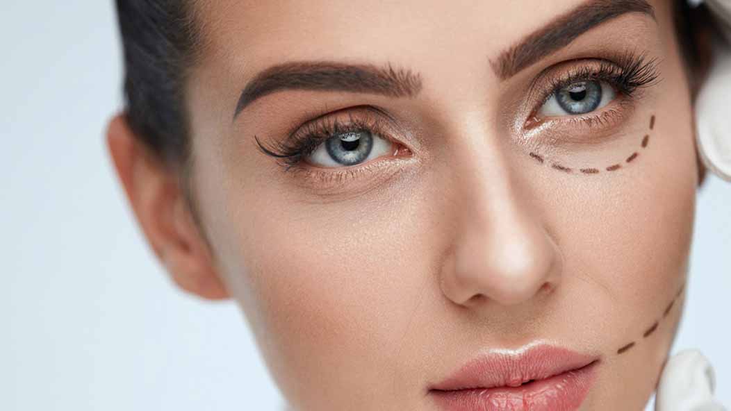 5 Reasons To Choose Eyelid Surgery