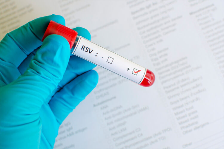 Vial of RSV blood