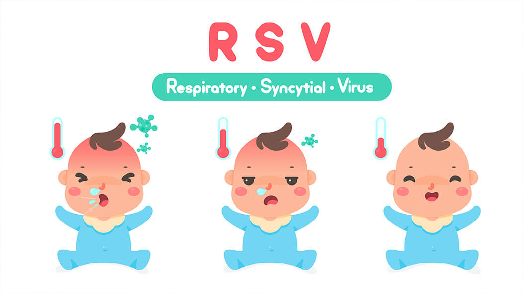 RSV Cases on the Rise