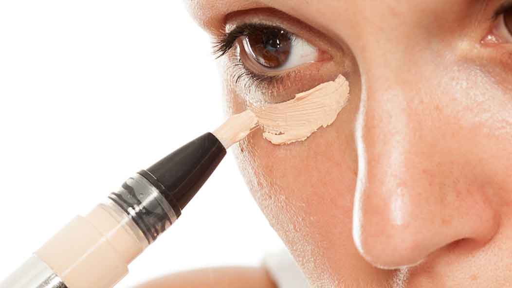 Bothered By Dark Under Eye Circles Carefully Applied Dermal Fillers May Be The Answer