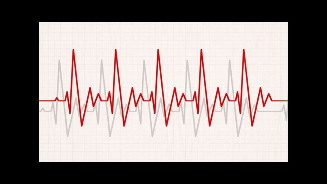 detecting and managing heart arrhythmias