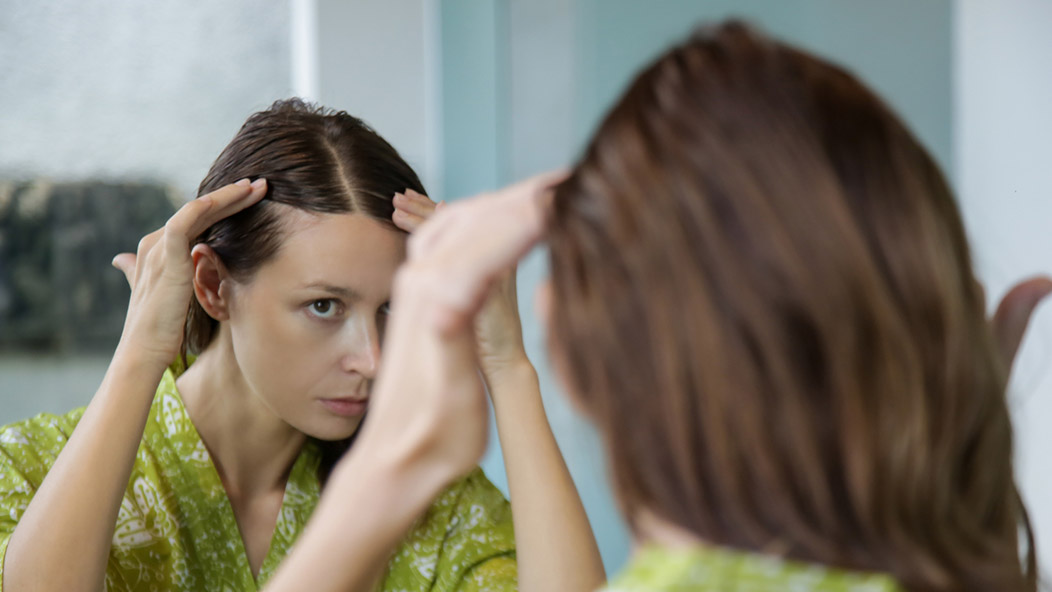 Female Hair Loss | Kelsey-Seybold Clinic