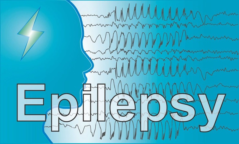 Epilepsy illustration