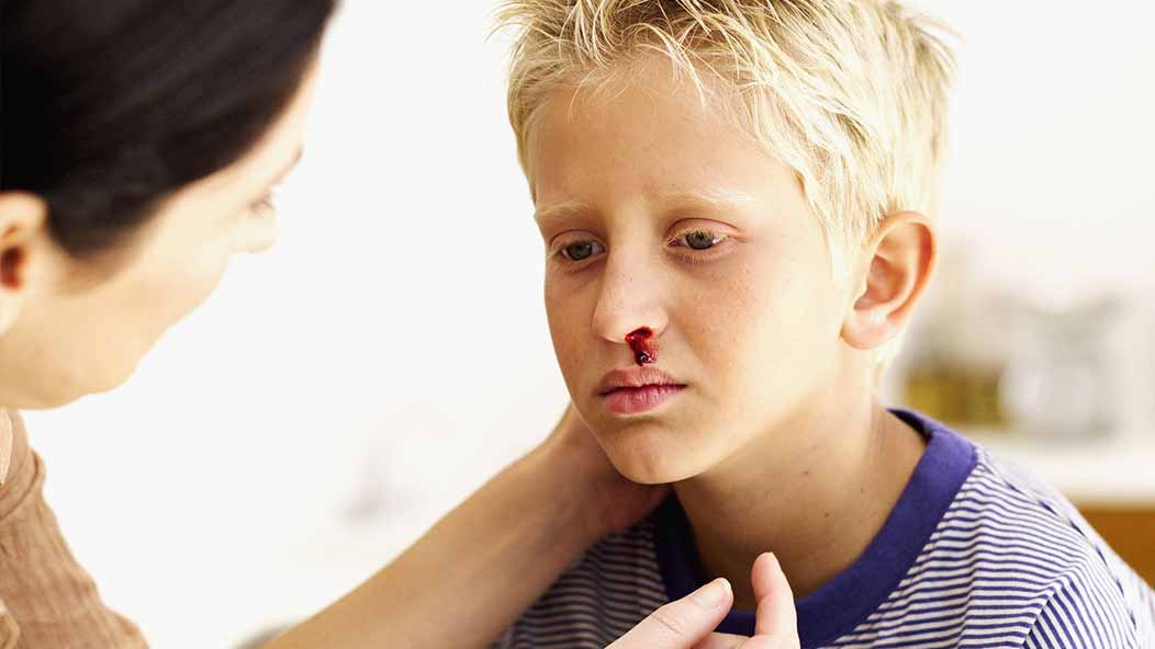 What to do when your child has a nosebleed