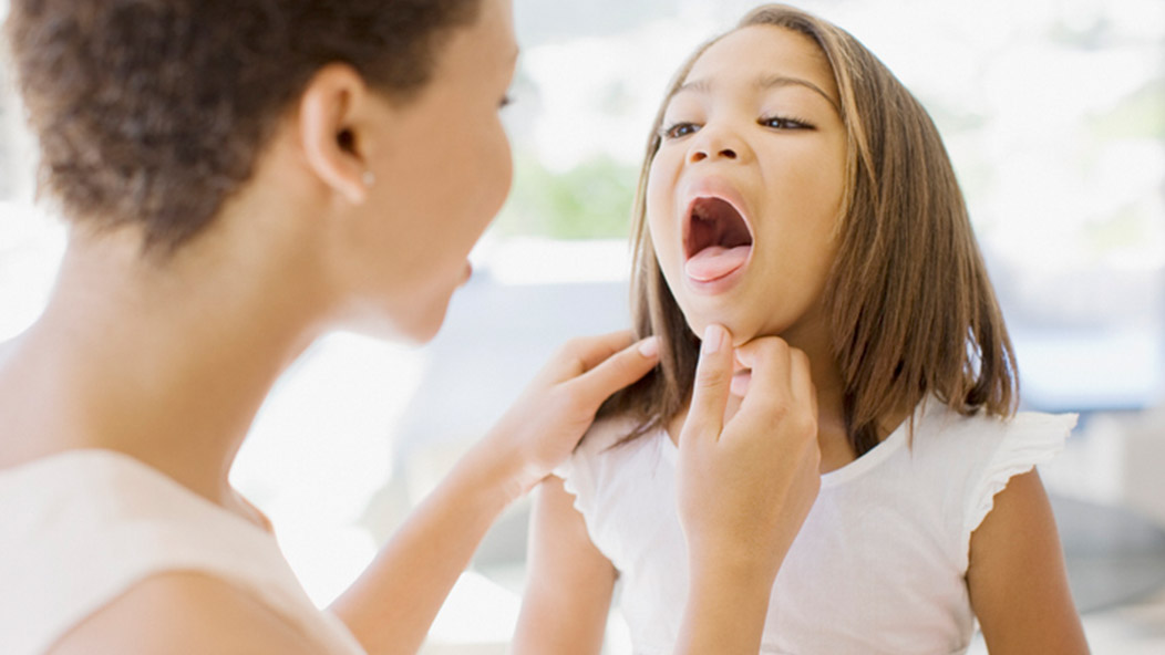 Signs and symptoms of strep throat