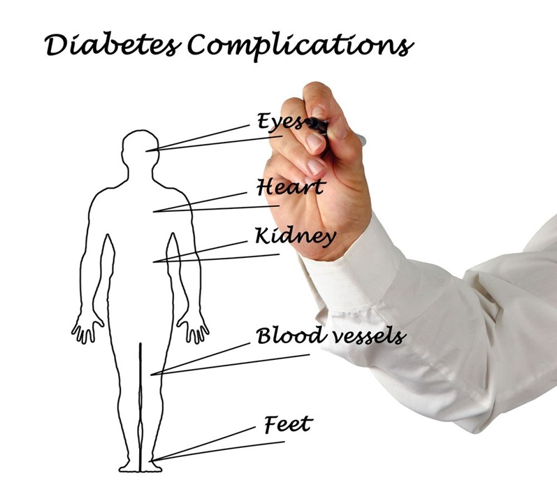 Diabetes complications illustration