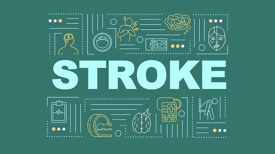 What You Should Know About Stroke