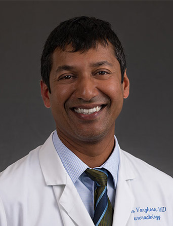Portrait of Thomas Varghese, MD, Radiology specialist at Kelsey-Seybold Clinic.